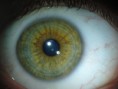 /album/iridologia/direita-central-jpg/